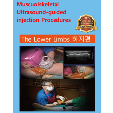 Musculoskeletal ultrasound-guided injection
