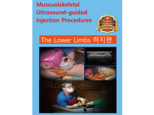 Musculoskeletal ultrasound-guided injection
